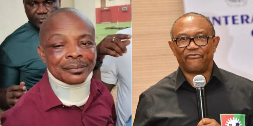 Peter Obi Condemns NLC President Ajaero’s Arrest