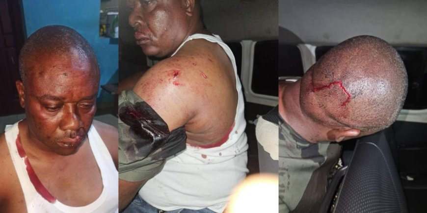 Bayelsa Gov Poll: Brass Local Council PDP Chairman Suffers Head Injury After Alleged Brutalisation By APC Thugs Over Election Materials