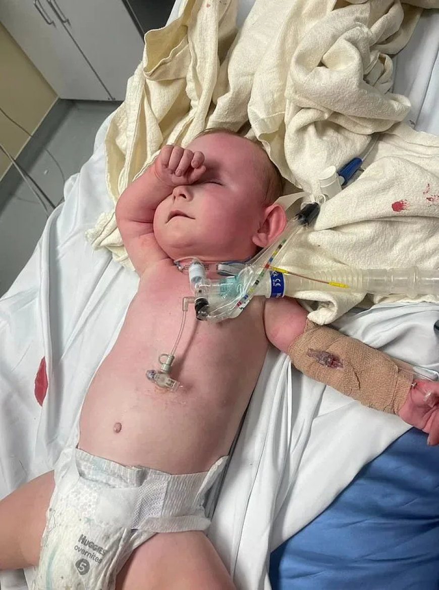 US police raid on wrong home leaves 17-month old special needs boy in ICU after cops threw two flash grenades 'hitting the baby